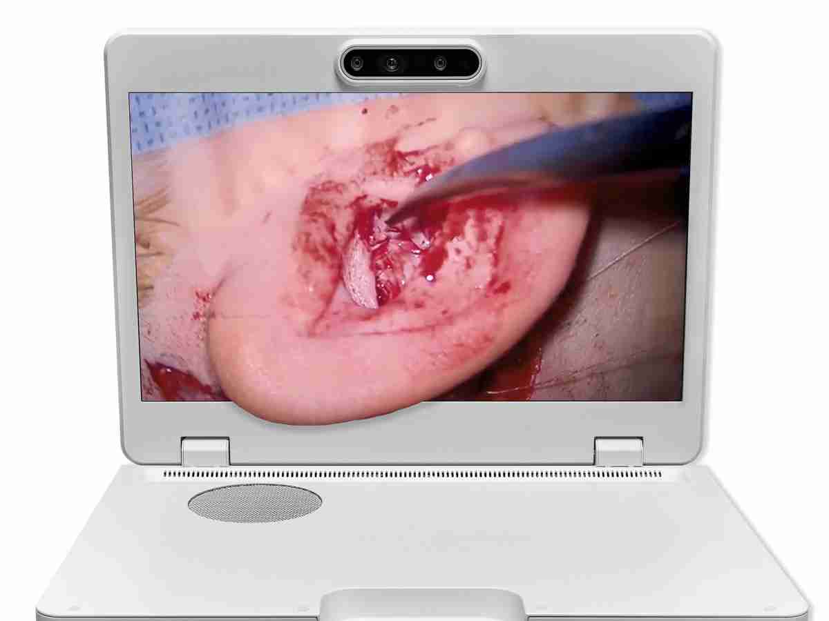 达擎之＂Heads-up 3D显微手术显示系统＂，，，，整合4K裸眼3D显示及眼球追踪系统，，具备快速追踪人眼移动位置功能，，，减轻医师长时间维持固定姿势的负担，，让医师能有更宽广清晰的3D立体视野及更舒适的姿势来执行手术。。。。